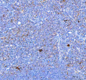 Anti-PD-1/PDCD1 Antibody