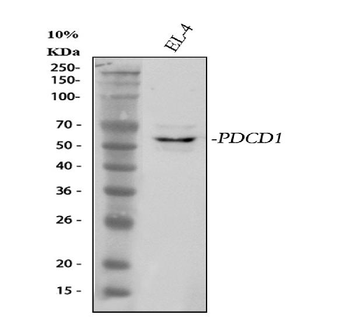 Anti-PD-1/PDCD1 Antibody