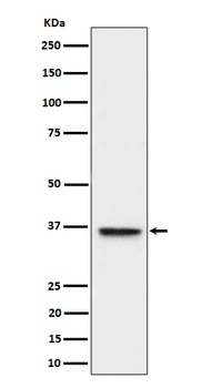 ULBP1 Rabbit Monoclonal Antibody