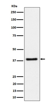UCHL5IP Rabbit Monoclonal Antibody