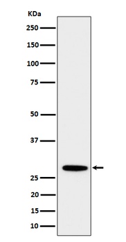 PSMB10 Rabbit Monoclonal Antibody