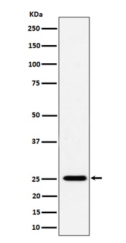 CFD Rabbit Monoclonal Antibody
