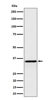 Pyrophosphatase 1 Rabbit Monoclonal Antibody