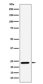 DNAJC12 Rabbit Monoclonal Antibody