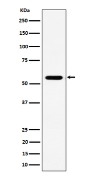 RNF14 Rabbit Monoclonal Antibody