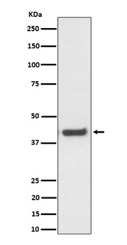 MVK Rabbit Monoclonal Antibody