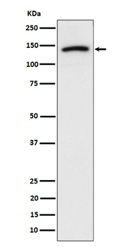 Cadherin 10 Rabbit Monoclonal Antibody