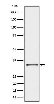 CYB5R3 Rabbit Monoclonal Antibody