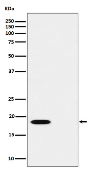 Phospho-PTS (S19) Rabbit Monoclonal Antibody