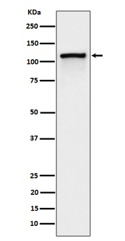 Phospho-CBL (Y774) Rabbit Monoclonal Antibody