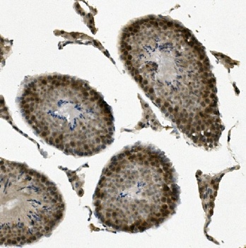 Anti-Human RBM45 Antibody