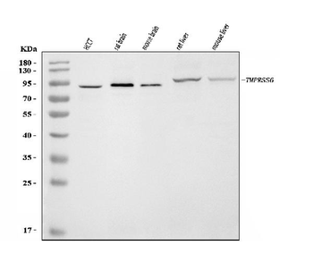 Anti-Matriptase 2/TMPRSS6 Antibody
