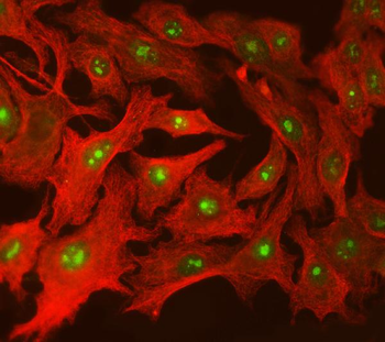 Anti-SPT5/SUPT5H Antibody