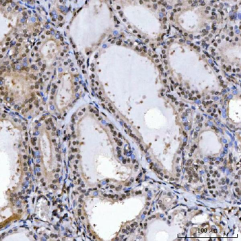 Anti-SPT5/SUPT5H Antibody
