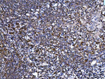 Anti-SPT5/SUPT5H Antibody