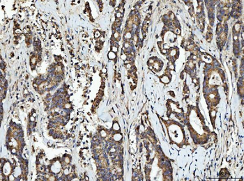 Anti-RGS12 Antibody