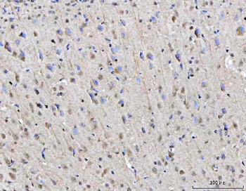 Anti-RGS12 Antibody