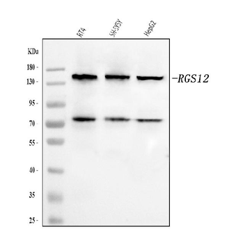 Anti-RGS12 Antibody