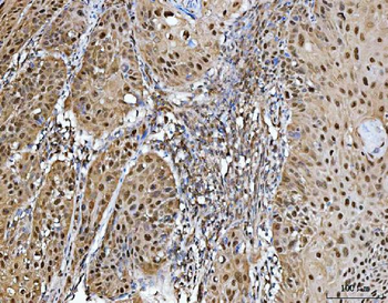 Anti-PRMT5 Antibody