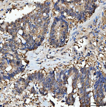 Anti-PRMT5 Antibody