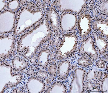 Anti-PRMT5 Antibody