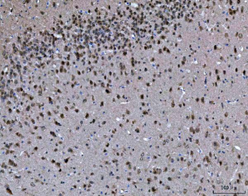 Anti-PRMT5 Antibody