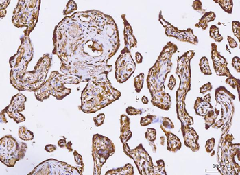PKIB Antibody
