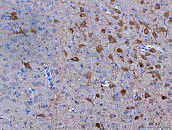 Anti-Nms Antibody