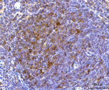 Anti-NCR1 Antibody