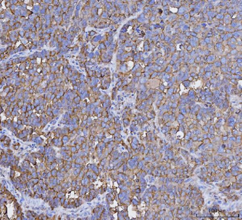 MUC1 Rabbit Polyclonal Antibody