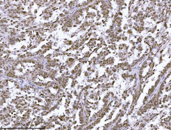 Anti-JHDM3A/JMJD2A/KDM4A Antibody