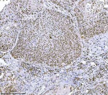 Anti-JHDM3A/JMJD2A/KDM4A Antibody