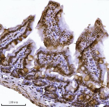 Anti-JHDM3A/JMJD2A/KDM4A Antibody