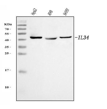 Anti-IL34 Antibody