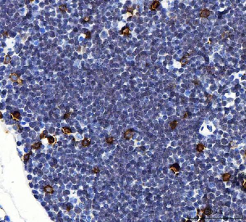 Anti-Il2ra Antibody