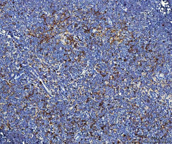 Anti-Il2ra Antibody