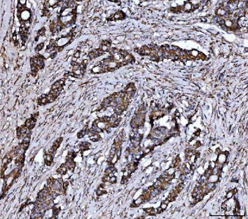 Anti-JAM-A/F11R Antibody