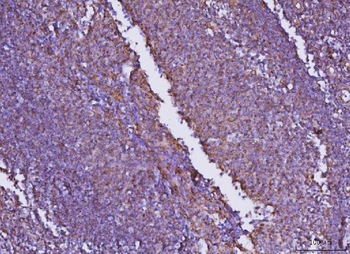Anti-JAM-A/F11R Antibody