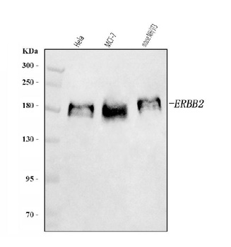 HER2/ERBB2 Antibody