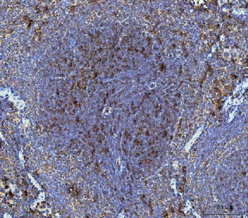 Anti-Dkk1 Antibody
