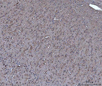 Anti-Dkk1 Antibody