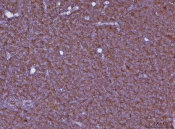 Anti-Cxcr3 Antibody