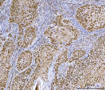 Anti-CUX1 Antibody