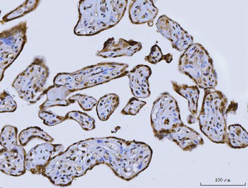 Anti-CUX1 Antibody