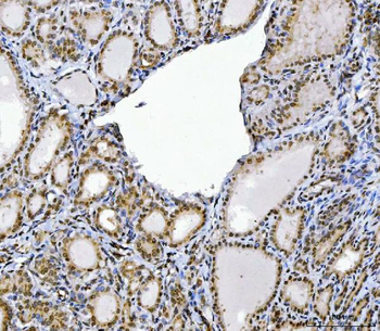 Anti-CUX1 Antibody