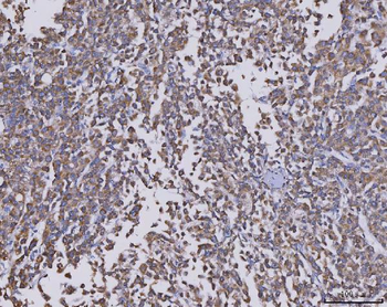 Anti-CCL14 Antibody
