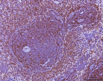 Anti-Ccl3 Antibody