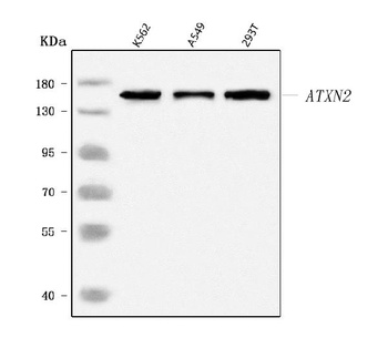 SCA2/ATXN2 Antibody