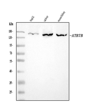 Anti-ATP7B Antibody