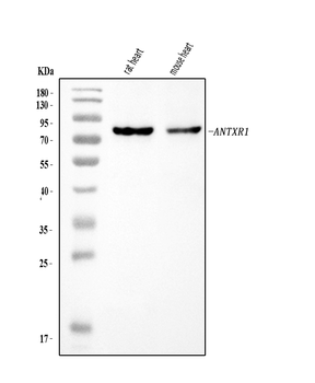 TEM8/ATR/ANTXR1 Antibody